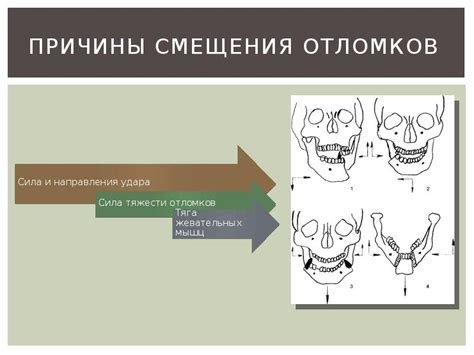 Решающий момент: причины смещения