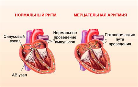 Риски полноценного кровотока