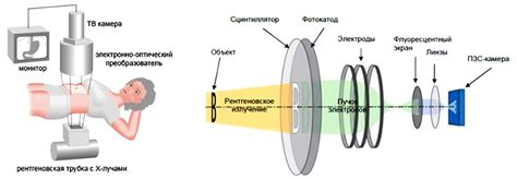 Риски рентгеновского исследования