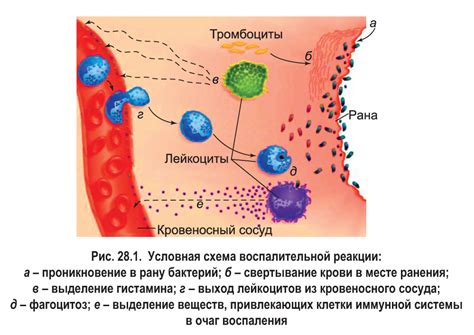 Риск развития воспаления и инфекции