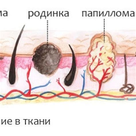 Родинки: основная информация и проблемы