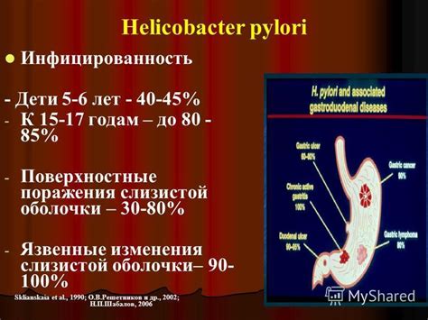 Роль лечения инфекции Helicobacter pylori в контроле веса