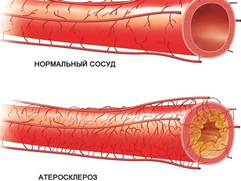 Роль массажа в лечении мастопатии