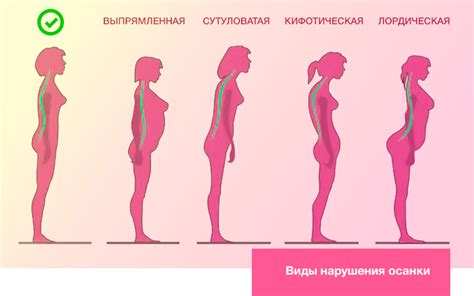 Роль неправильной осанки в возникновении проблем с зевком и дыханием