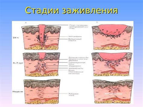 Роль питания и гигиены в процессе заживления раны