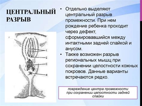 Ручное зашивание разрывов