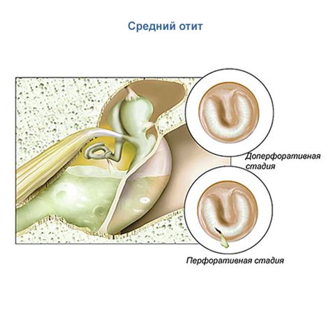 Самостоятельные способы лечения