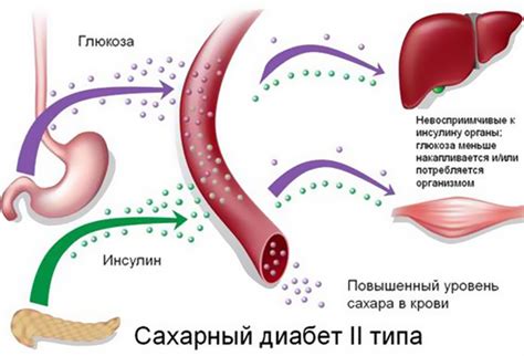 Сахарный диабет и проблемы с иммунной системой