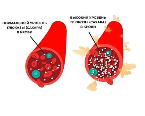 Сахарный диабет и соки: что особенно важно знать