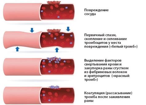 Свертывание крови