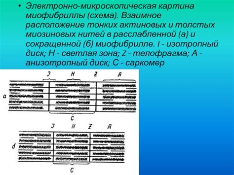 Связь толстых миозиновых нитей с другими компонентами мышцы