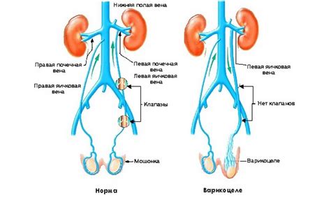 Связь физической нагрузки и уменьшения размера яичек у мужчин