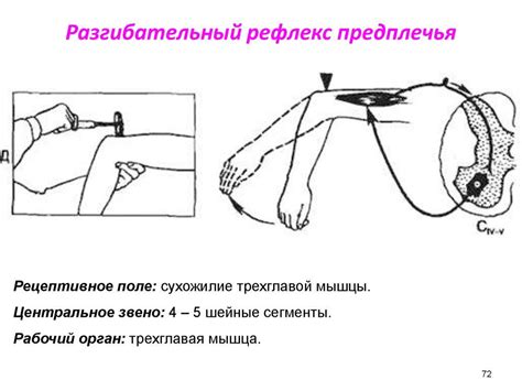 Сгибательный рефлекс