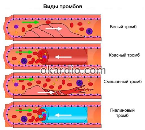 Сдавление сосудов