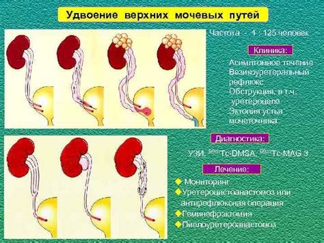 Серьезные повреждения мочевых путей