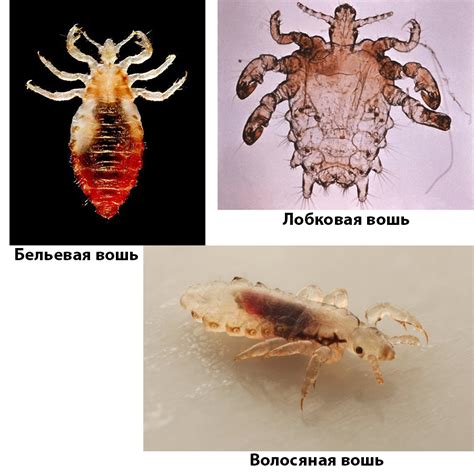 Симптомы, причины и последствия постельных вшей