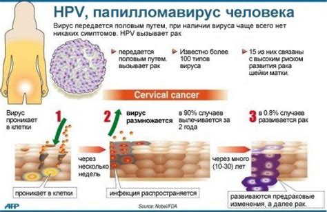 Симптомы и диагностика ВПЧ