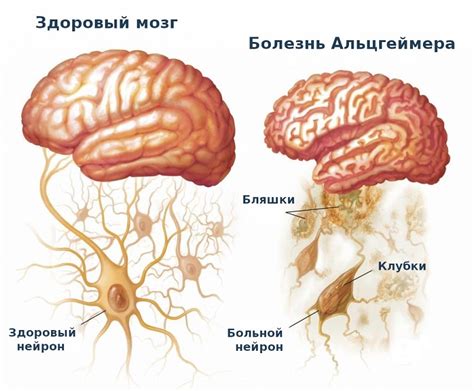 Симптомы и начальные признаки