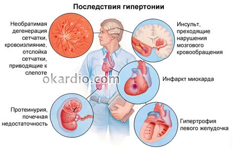 Симптомы и последствия гипертонии