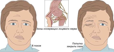 Симптомы и последствия поражения