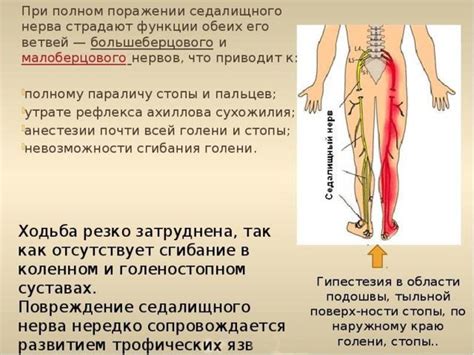 Симптомы и признаки воспаления седалищного нерва