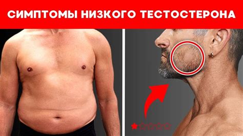 Симптомы и признаки низкого уровня тестостерона