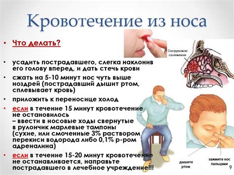 Симптомы кровотечения из носа