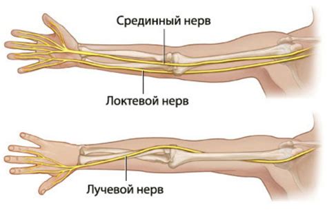 Синдром отцепления нерва