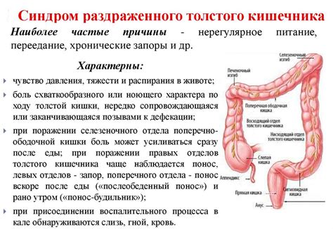 Синдром раздраженного толстого кишечника