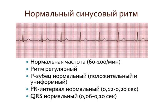 Синусовый ритм: основные характеристики