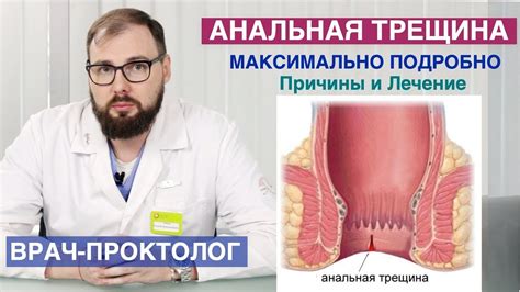 Скучные трещины или что это?