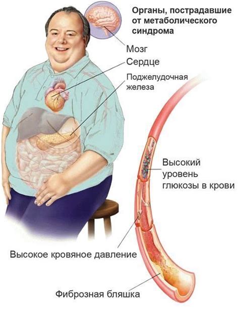 Сладкие заменители могут вызвать метаболический синдром