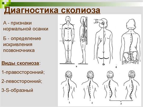 Советы по поддержанию правильной позы при массаже ЛФК