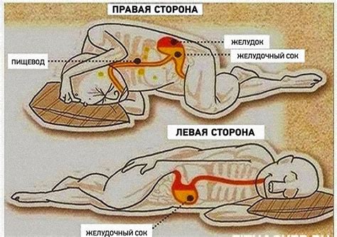 Советы по снятию головокружения на левом боку