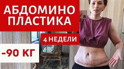 Советы специалистов по удалению живота дома