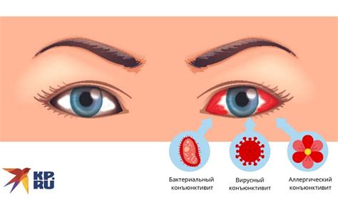 Современные методы лечения гнойного заусенца