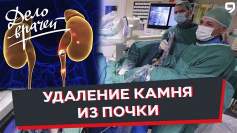 Современные методы лечения и профилактика образования камня в почке