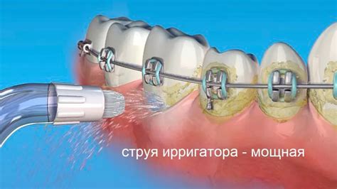 Сода для улучшения состояния полости рта