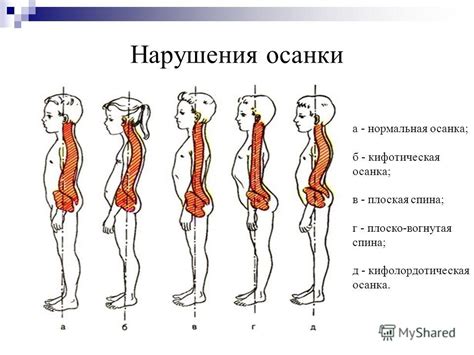 Создание и установление прямой осанки