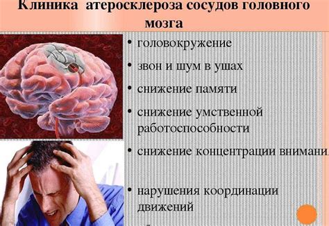 Сосудистые причины болей