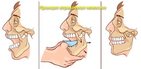 Спазмы нижней челюсти при зевании