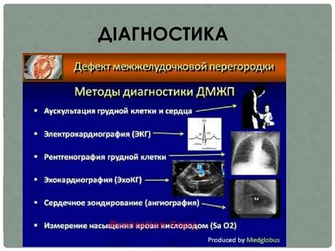 Способы диагностики дефекта