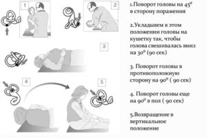 Способы лечения головокружения при астме