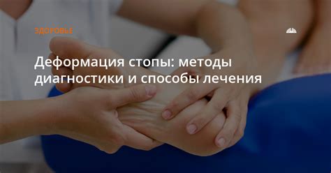 Способы лечения зуда внутри стопы