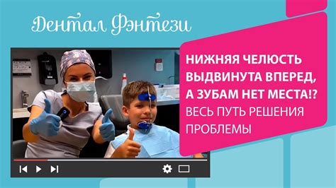 Способы решения проблемы с шитьем вперед