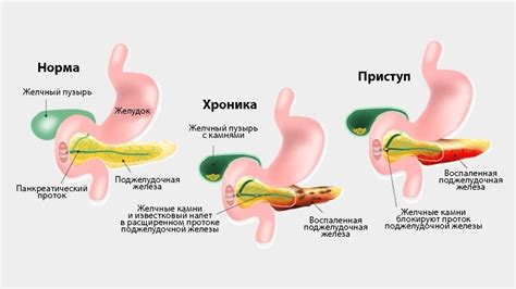 Способы снятия аганима