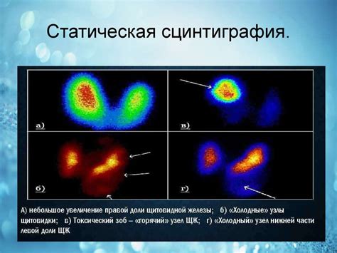 Статическая и динамическая настройка селекции