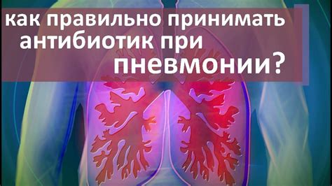 Тайминг прогулок при пневмонии