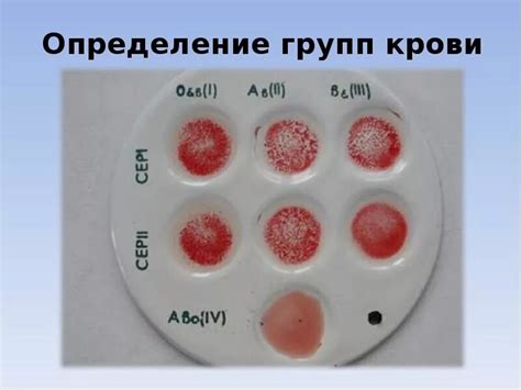 Тестирование группы крови А2 методом агглютинации