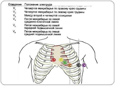 Техника проведения ЭКГ